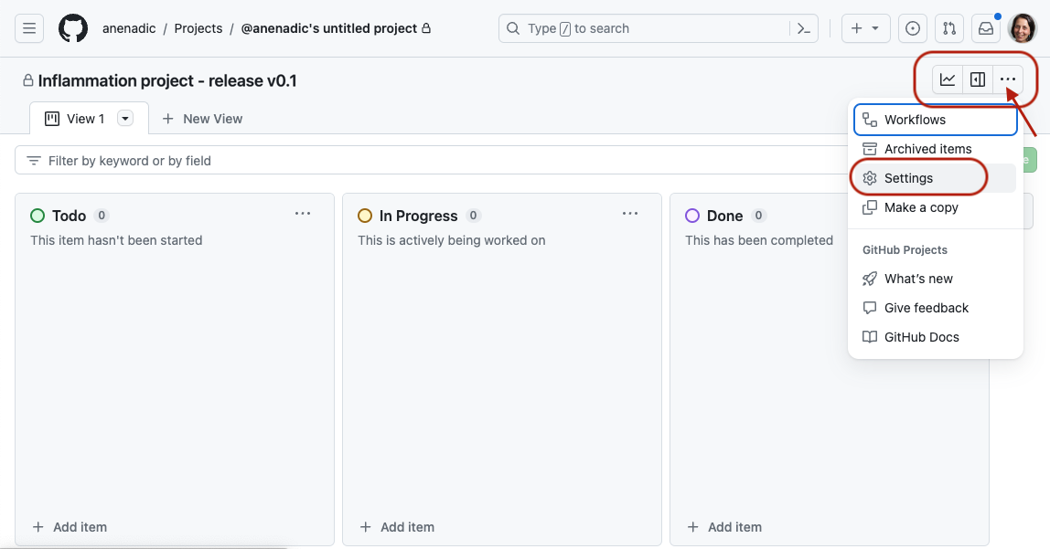 Project board setting in GitHub